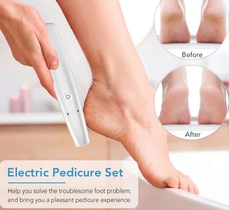 Electric Pedicure Foot || Callus Remover